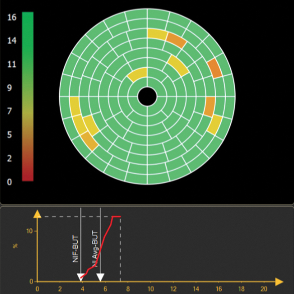 IDRA-STEP-03.jpg