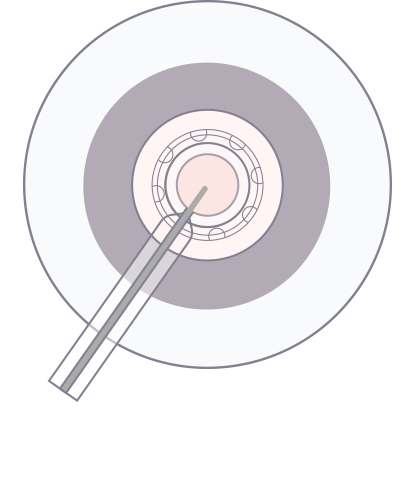 step-2.png