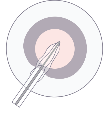 step-1.png