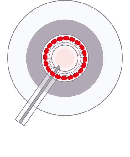 step-3.png