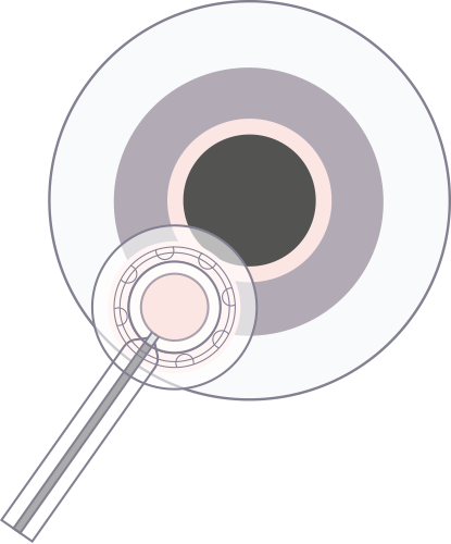step-4.png