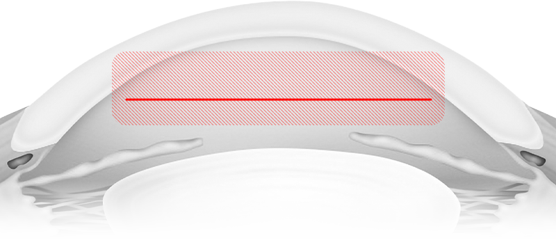 img-2-2.png