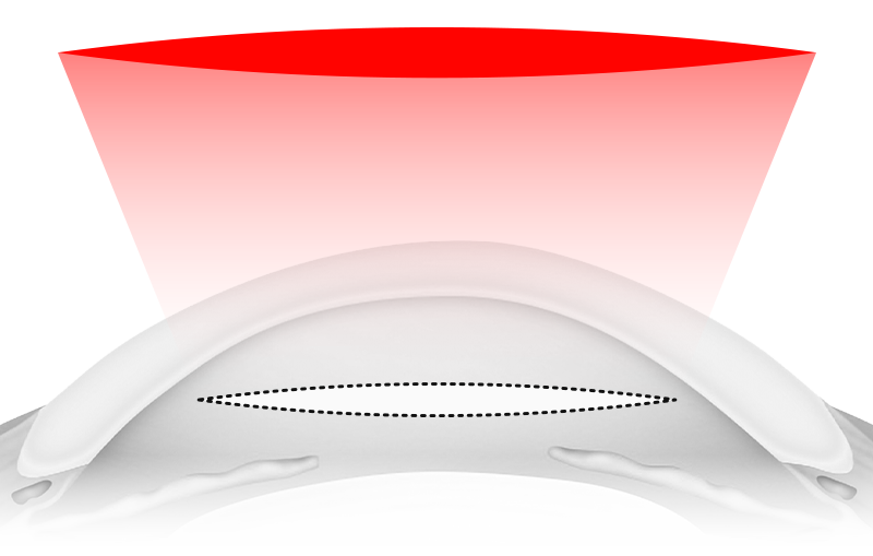 img-1-2.png